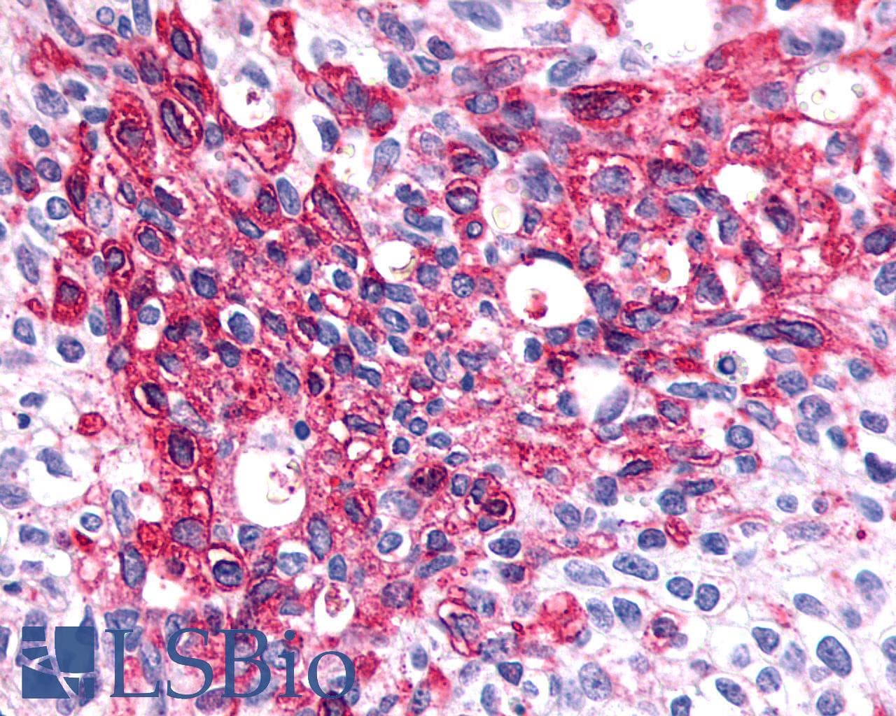 PathPlus™ SSTR1 Antibody (N-Terminus)