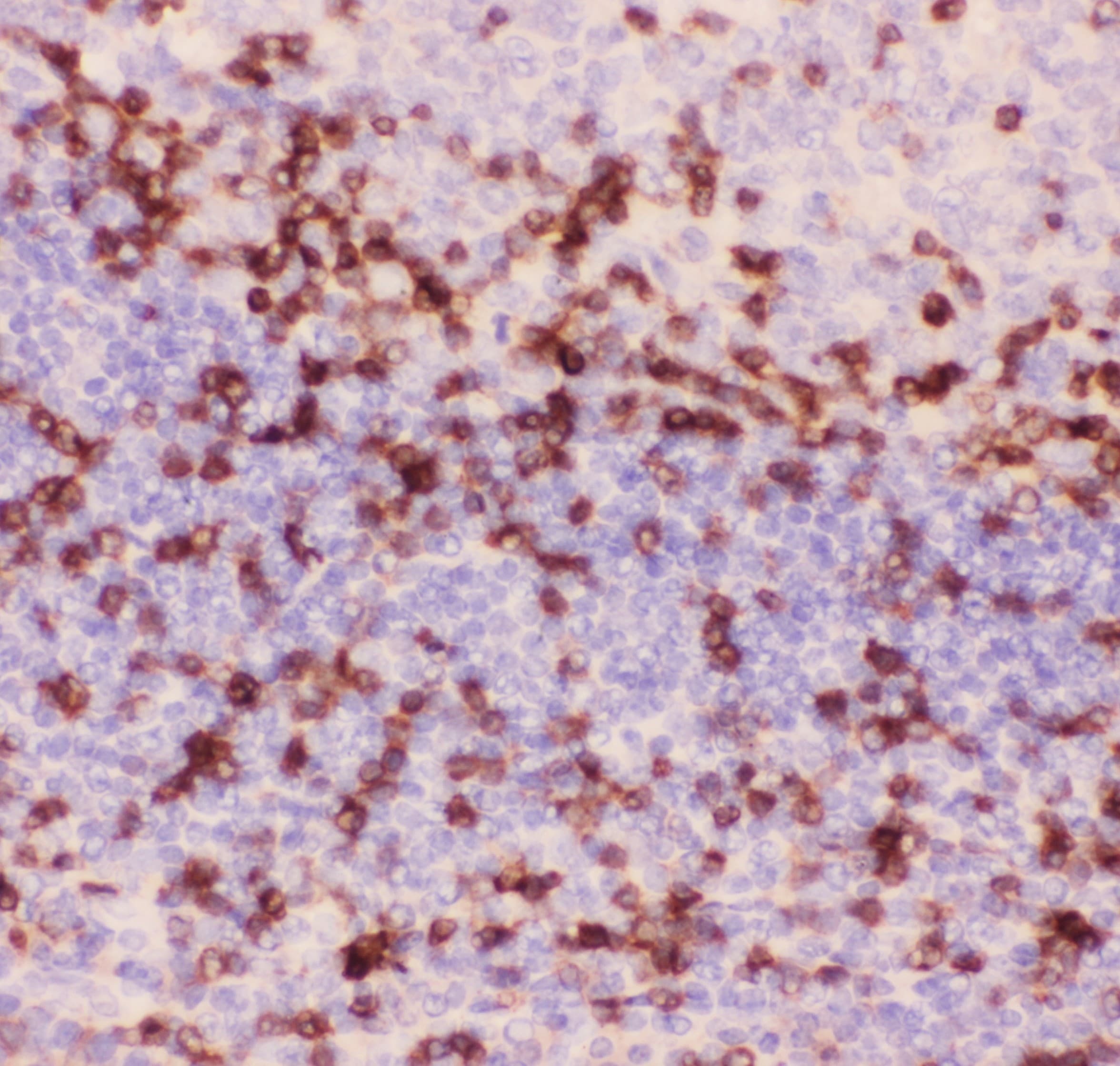 CD3E Antibody (aa23-207)
