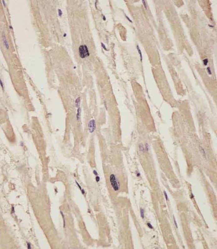 COL14A1 / Collagen XIV Antibody (Internal)