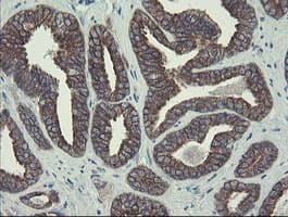 DPH2 Antibody (clone OTI3A12)