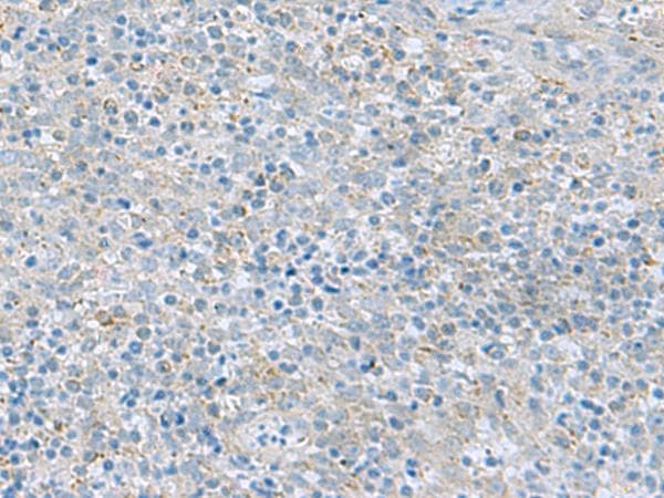 P5CR2 / PYCR2 Antibody