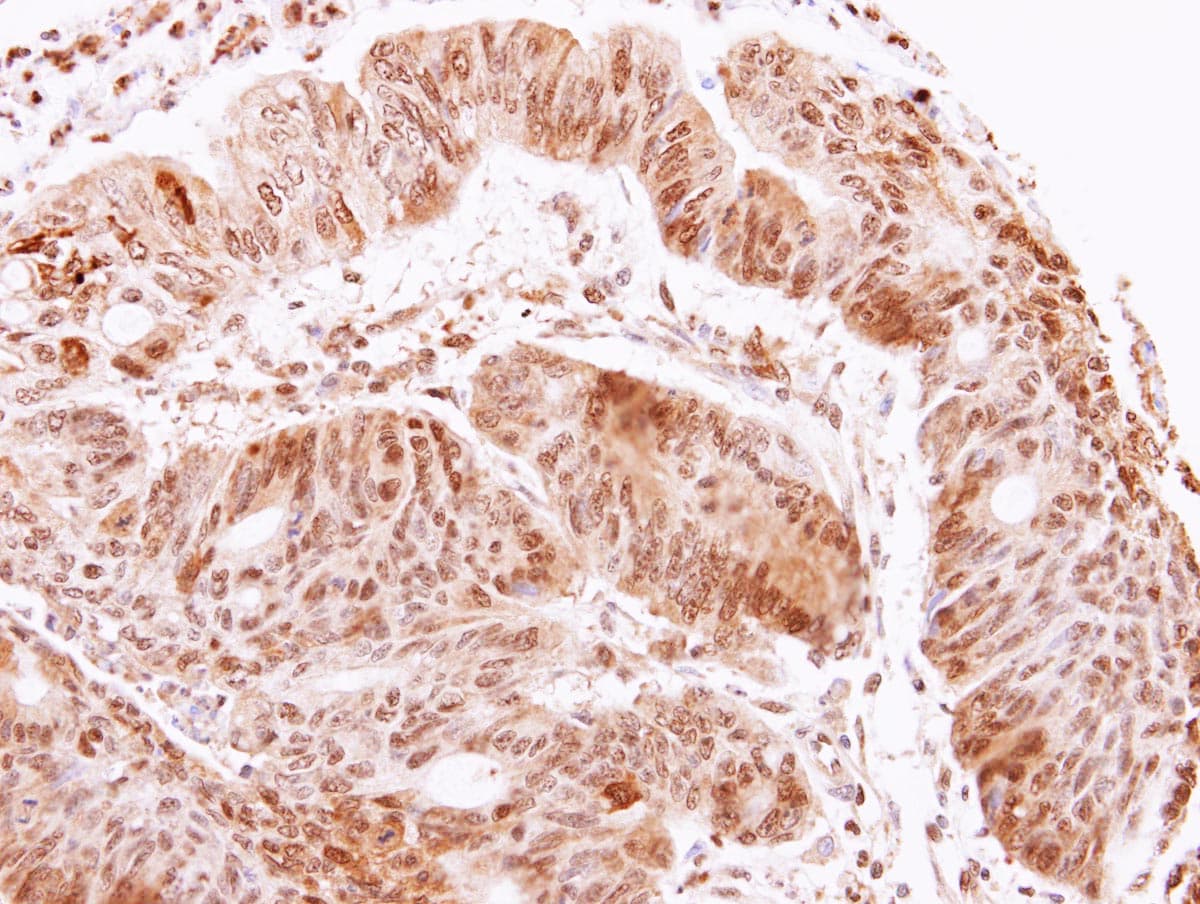 ACHE / Acetylcholinesterase Antibody (aa406-614)