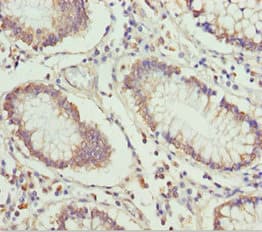 ETFA Antibody