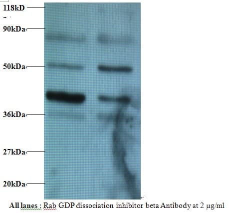 IHC-plus™ GDI2 Antibody