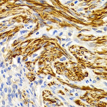 EDA / Ectodysplasin A Antibody