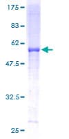 Human UQCRFS1 Protein (Recombinant GST)
