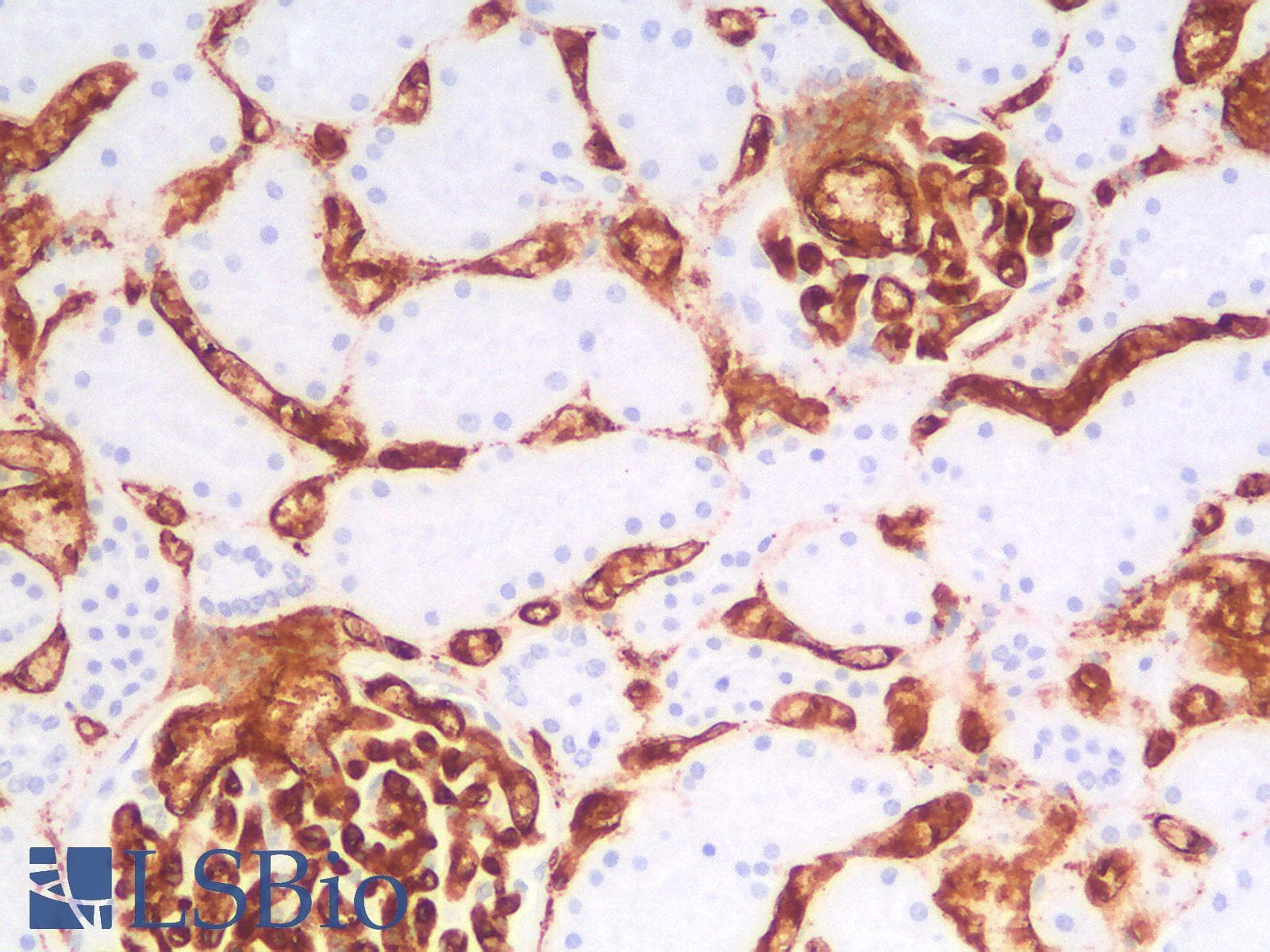 PathPlus™ Recombinant Monoclonal Rabbit anti-Human CD34 Antibody (clone HPCA1/2598R, IHC)
