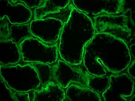 Monoclonal Rat anti-Human ITGA6/Integrin Alpha 6/CD49f Antibody (clone GoH3, IHC)