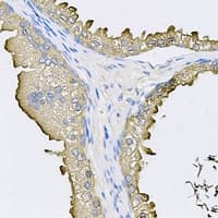 FABP12 Antibody