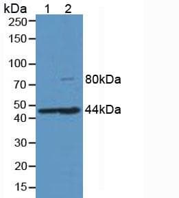 HFE2 / Hemojuvelin Antibody