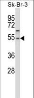 PPM1A / PP2CA Antibody (aa355-382)