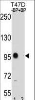 Polyclonal Rabbit anti-Human CTNNB1 / Beta Catenin Antibody (aa723-751, WB)