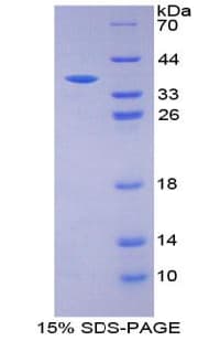 Bovine Insulin Protein (Recombinant His-GST)