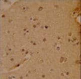 SOX4 Antibody (aa86-114)