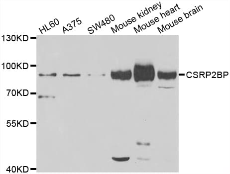 IHC-plus™ CSRP2BP Antibody