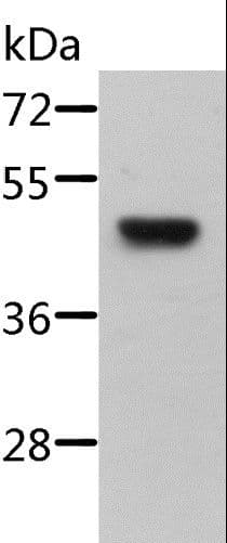 STRADB / ALS2CR2 Antibody