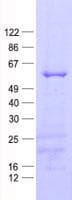 Human MMP20 Protein (Recombinant His, N-Terminal)