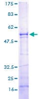 Human SPSB1 Protein (Recombinant GST)