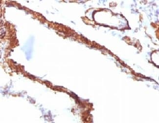 ACTA2 / Smooth Muscle Actin Antibody (clone SMAT2-1, Ready-to-Use)