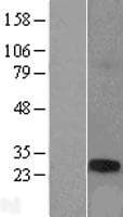 TCP10L Protein (Over-Expression Lysate Myc-DDK (Flag))