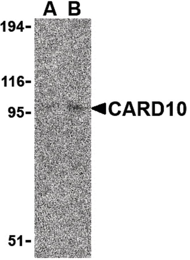 IHC-plus™ CARD10 / CARMA3 Antibody