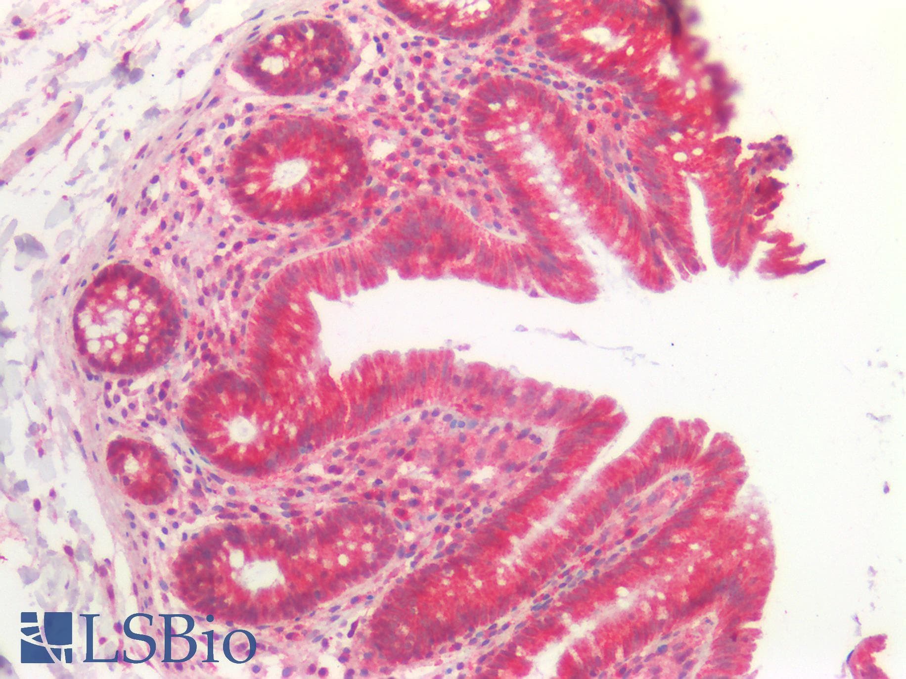 IHC-plus™ Polyclonal Rabbit anti-Human MAPRE2 / EB2 Antibody (IHC)
