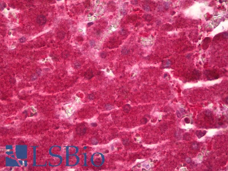IHC-plus™ Polyclonal Rabbit anti-Human CYP39A1 Antibody (aa361-410, IHC, IF, WB)