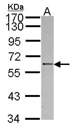 RBMY1A1 Antibody (aa1-241)