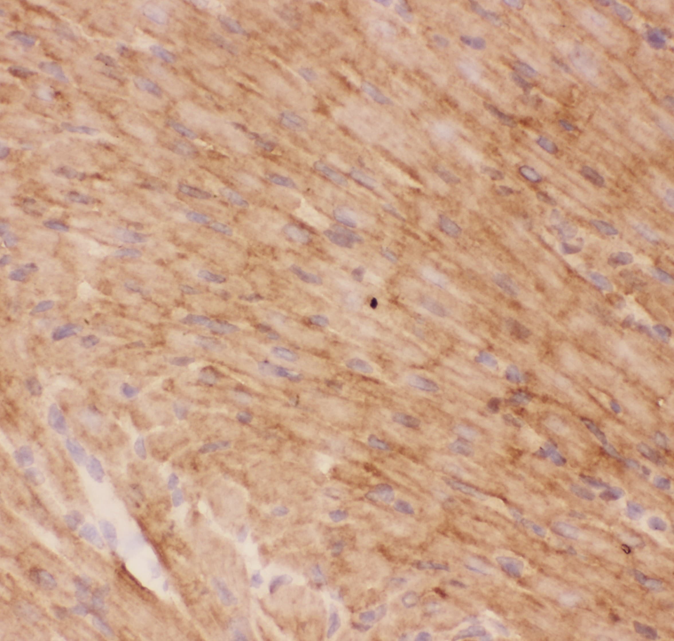 SLC2A4 / GLUT-4 Antibody (aa333-509)