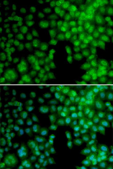 Polyclonal Rabbit anti-Human Vitamin D Receptor / VDR Antibody (IHC, IF, WB)