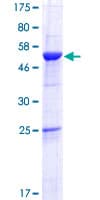 Human ROGDI Protein (Recombinant GST)