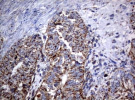 PIK3CD / PI3K Delta Antibody (aa286-610, clone OTI2H3)