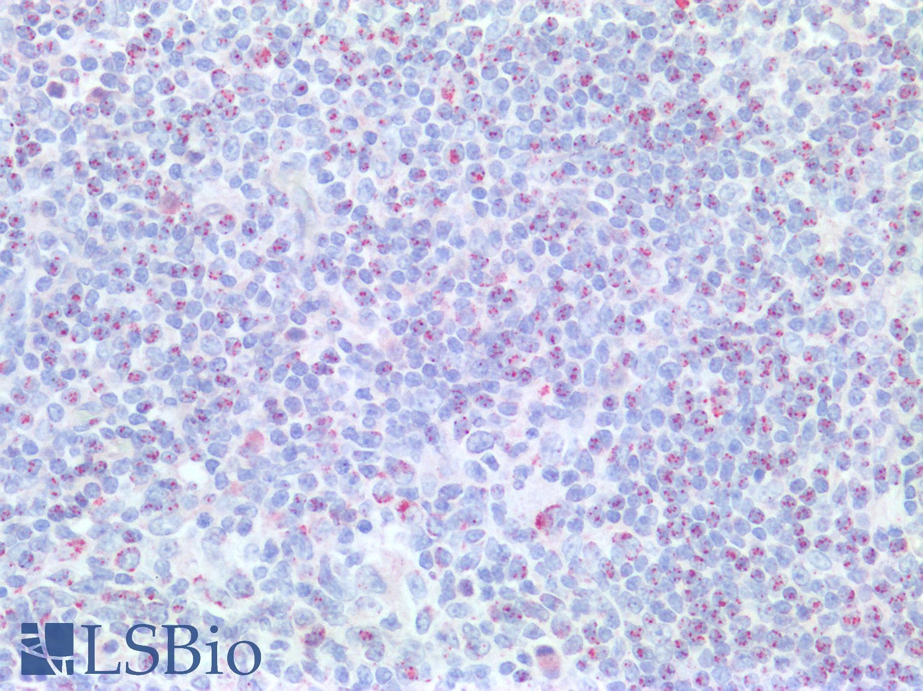 IHC-plus™ BCL2 / Bcl-2 Antibody