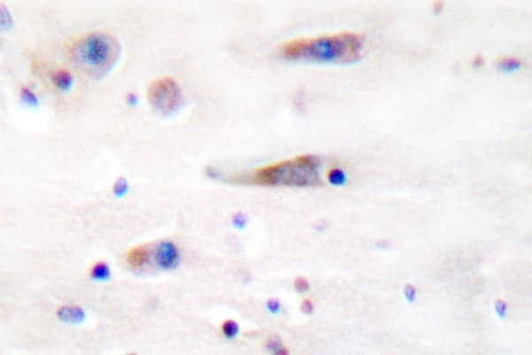 GRIN1 / NMDAR1 Antibody (Phe891)