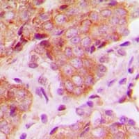 MRPS22 Antibody (Internal)