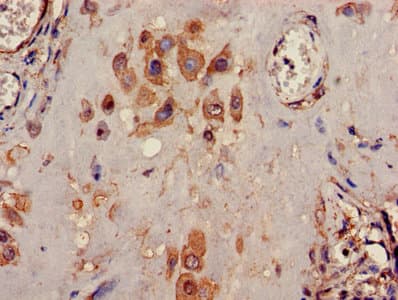 Polyclonal Rabbit anti-Human TWIK1 / KCNK1 Antibody (IHC, IF)