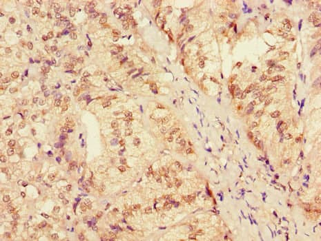 ZRANB3 Antibody