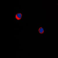ARRDC1 Antibody (Internal)