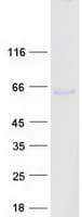Human PNPLA3 / Adiponutrin Protein (Recombinant Myc-DDK (Flag))