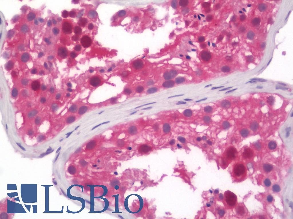 IHC-plus™ COMMD1 Antibody (clone 2E2)