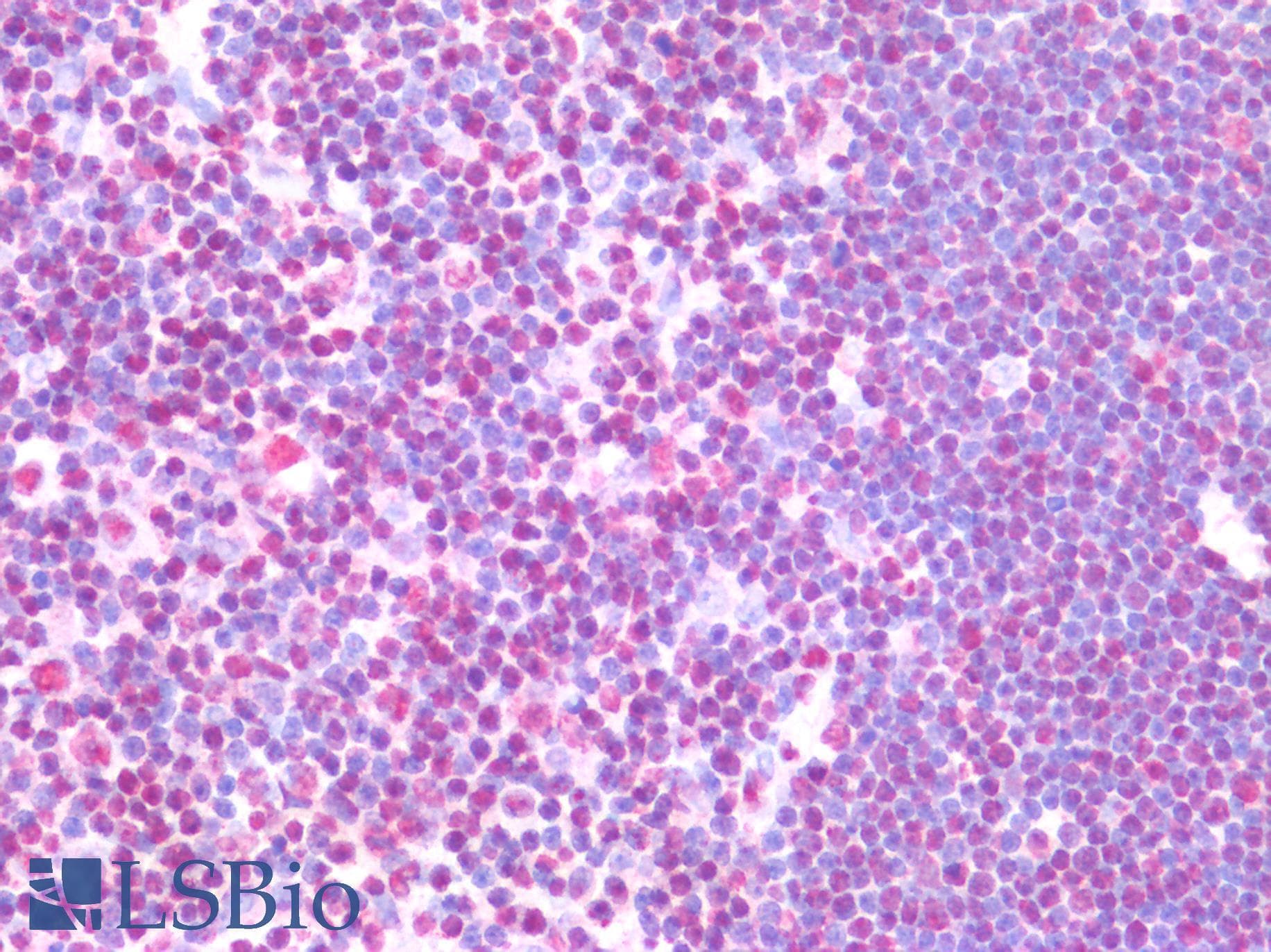 IHC-plus™ Monoclonal Mouse anti-Human PTBP3 / ROD1 Antibody (clone OTI5C9, aa300-552, IHC, WB)