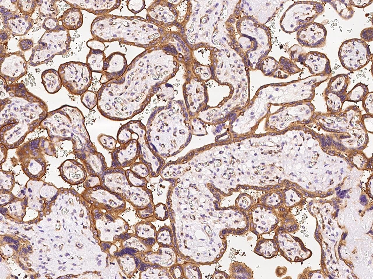 OXA1L / OXA1 Antibody