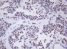 MORF4 Antibody (aa1-255, clone OTI5F2, Carrier-free)