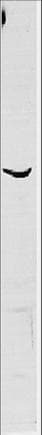 BIVM Antibody