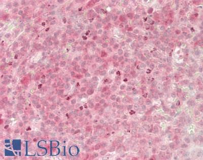 IHC-plus™ LY96 / MD2 / MD-2 Antibody