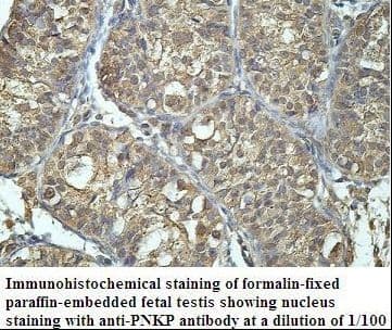 Polyclonal Rabbit anti-Human PNKP Antibody (aa253-418, IHC, WB)