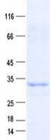 Human METRN / Meteorin Protein (Recombinant His, N-Terminal)