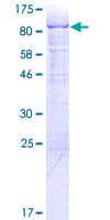 Human RBM6 / 3G2 Protein (Recombinant GST)