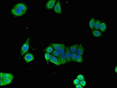IHC-plus™ Polyclonal Rabbit anti-Human GPI Antibody (aa2-554, IHC, IF, WB)