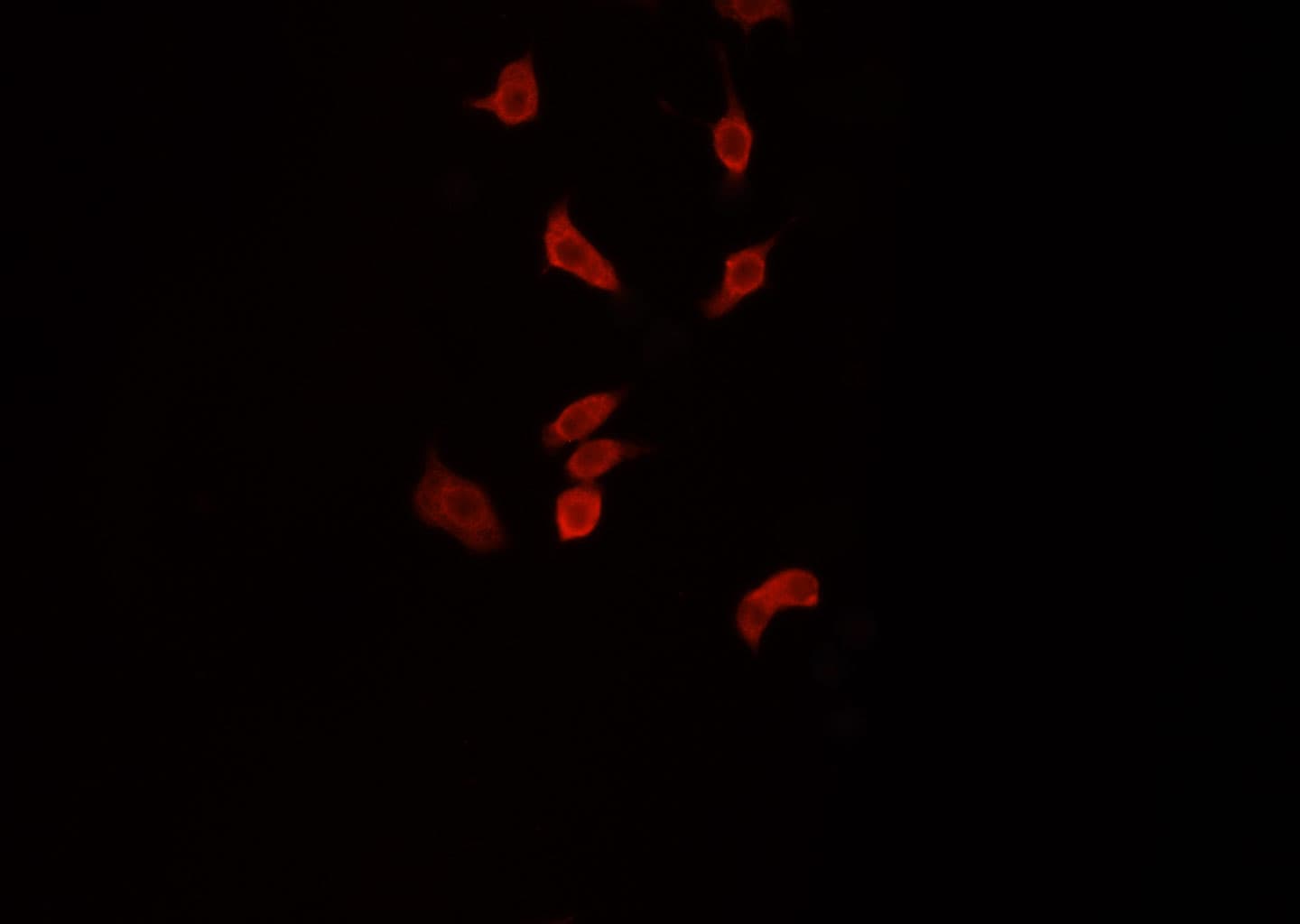Polyclonal Rabbit anti-Human SNCB / Beta-Synuclein Antibody (IHC, IF, WB)